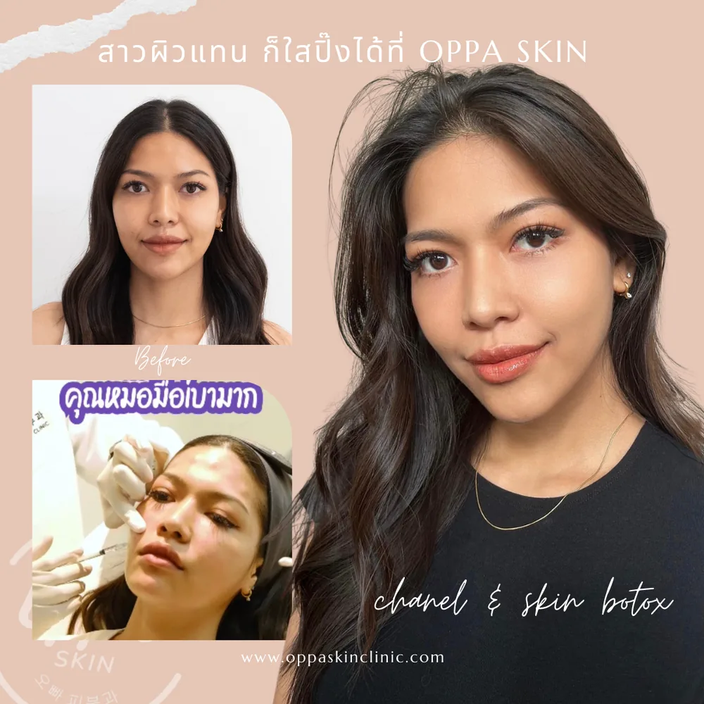 ตัวอย่างผลลัพธ์ Oppa Signature Facial