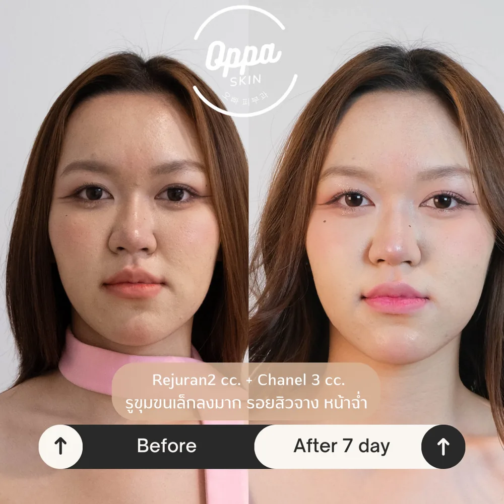 ตัวอย่างผลลัพธ์ Anti-aging Program