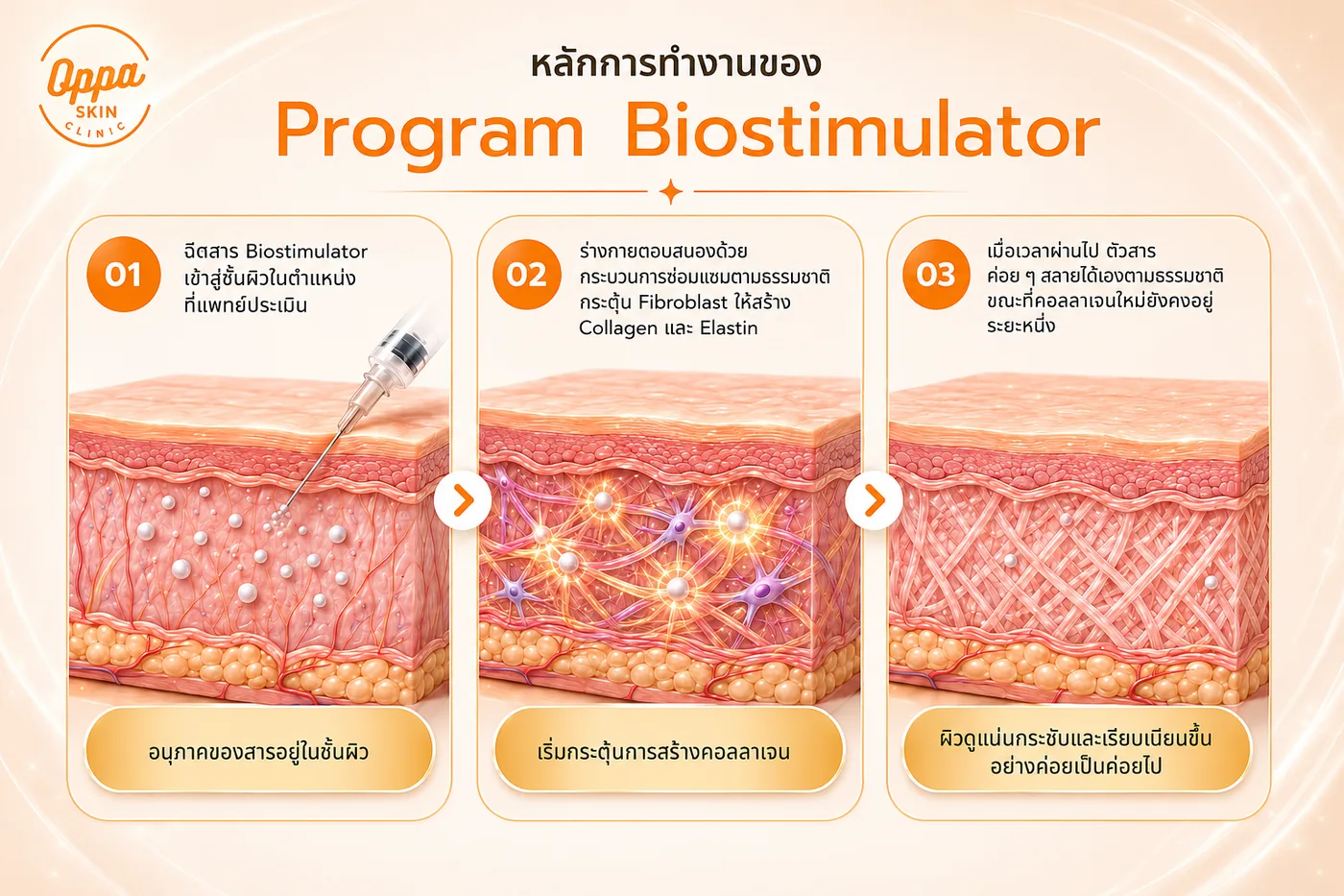 หลักการทำงานของ Biostimulator
