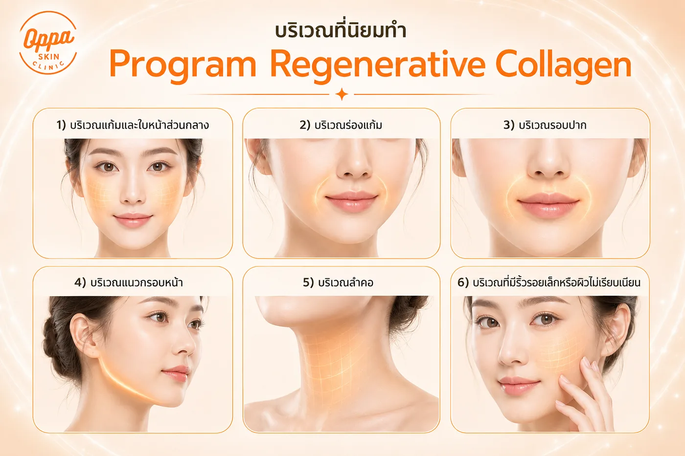 บริเวณที่นิยมทำโปรแกรม Regenerative Collagen