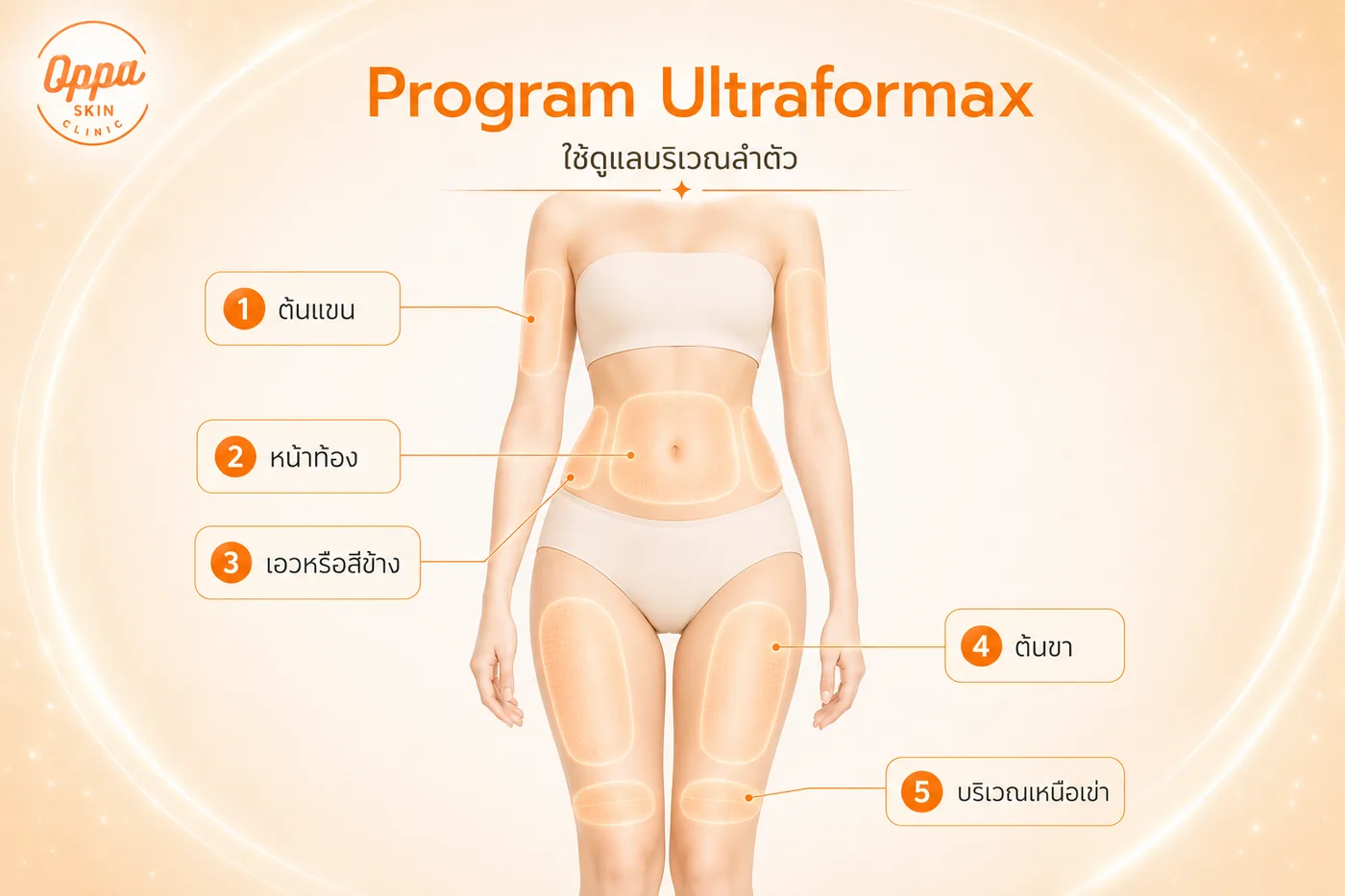 ตำแหน่งการทำโปรแกรม Ultraformax บริเวณลำตัว