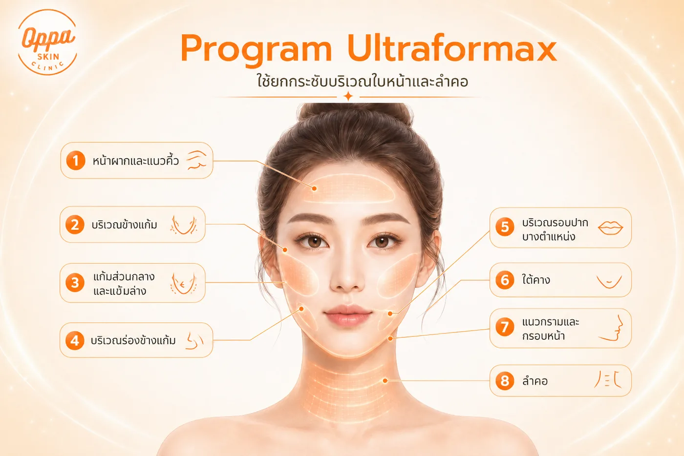 ตำแหน่งการทำโปรแกรม Ultraformax บริเวณใบหน้าและลำคอ