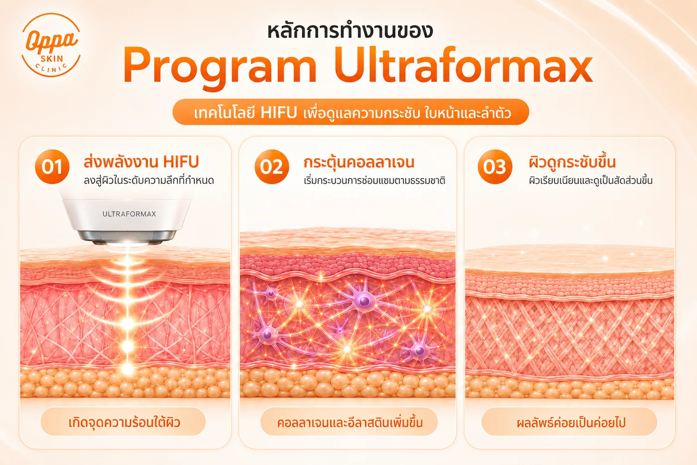 หลักการทำงานของเครื่อง Ultraformax