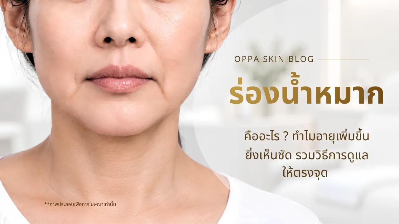 ร่องน้ำหมากเป็นการเปลี่ยนแปลงของใบหน้าส่วนล่าง