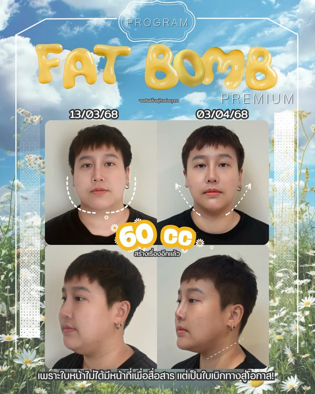 ตัวอย่างผลลัพธ์ โปรแกรม Fat Bomb Premium
