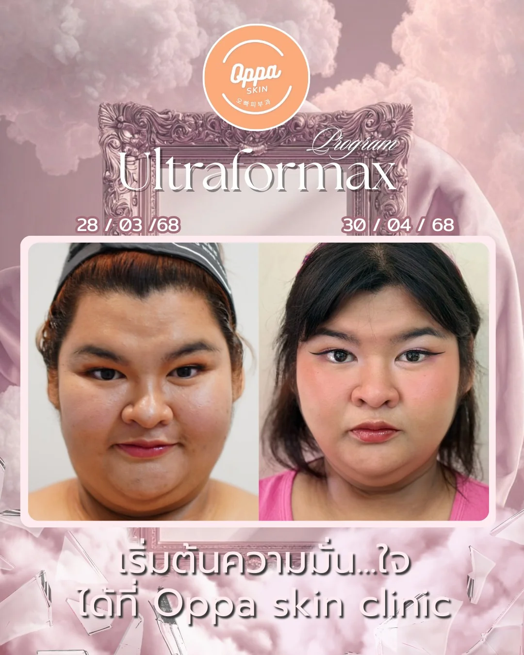 ตัวอย่างผลลัพธ์ โปรแกรม Ultraformax